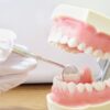 埋伏歯を急速拡大装置を使って治療する体験談!抜歯せず放置するとどうなる?